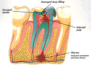 East Cobb Endodontics