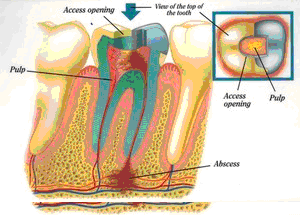 East Cobb Endodontics