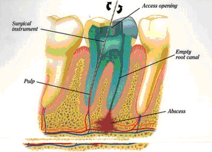 East Cobb Endodontics