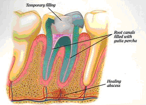 East Cobb Endodontics