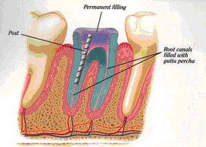 East Cobb Endodontics