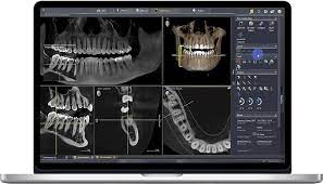 cbct stock image